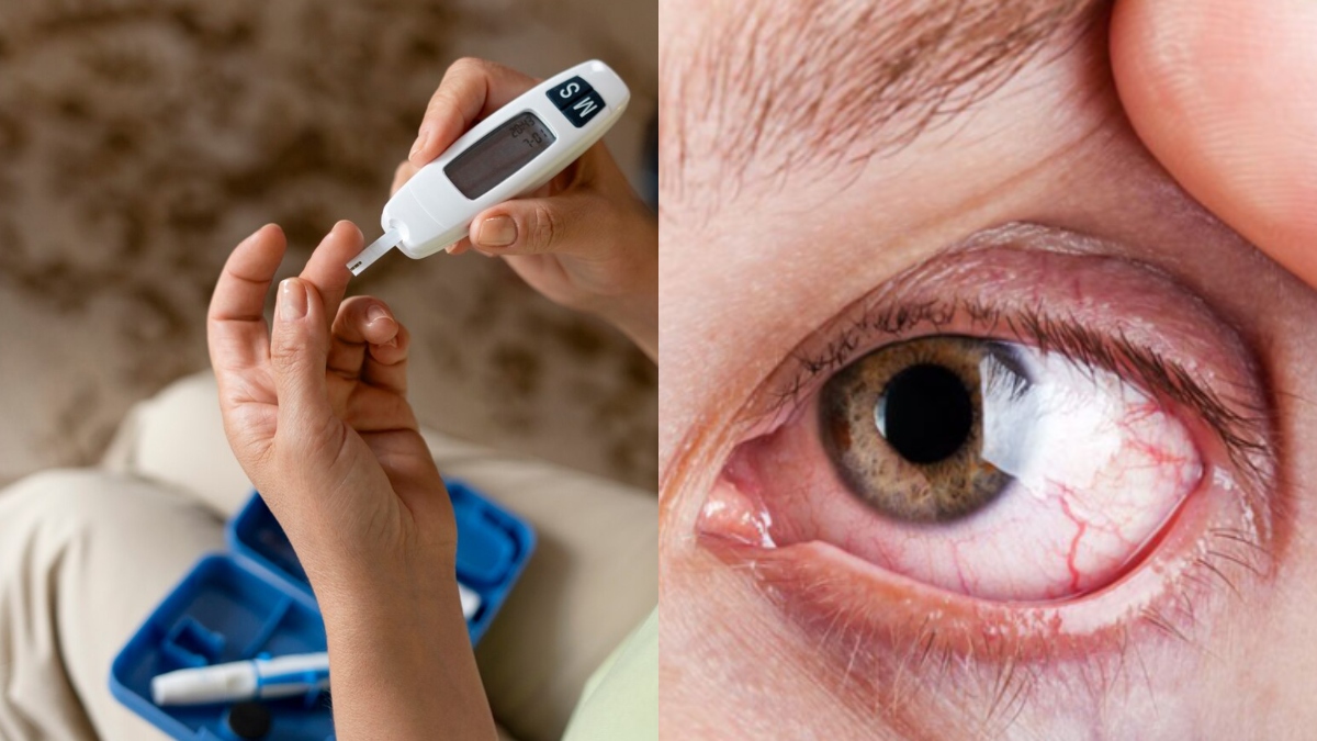 Tips for Effective Treatment of Diabetic Eye Disease